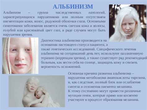 Как предотвратить развитие альбинизма