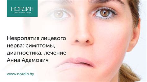Как предупредить и лечить паралич лица