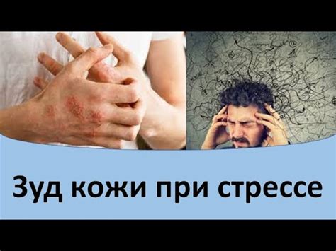 Как прекратить краснеть при неожиданном внимании: основные способы и советы