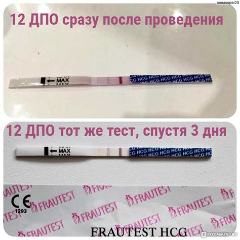 Как работает тест беременности
