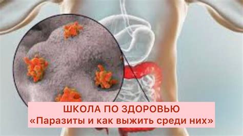 Как распространены паразиты среди населения