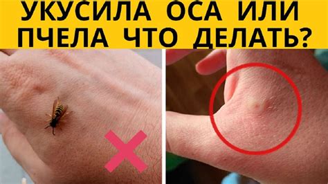 Как связаны симптомы укуса осы и повышение температуры