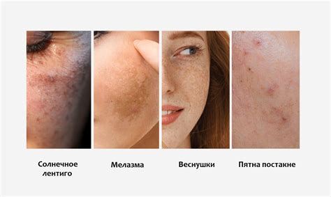 Как удалить кожу с человека: методы и особенности