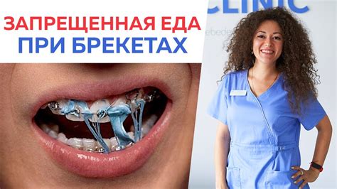 Как уменьшить дискомфорт при употреблении хлеба с брекетами