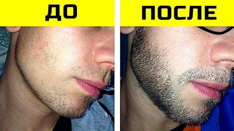 Как ускорить рост шерсти после стрижки