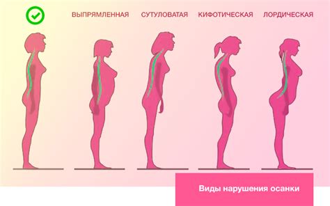 Калории, тратимые на поддержание осанки