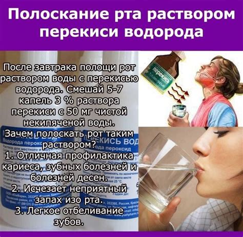 Классический способ промывания рта перекисью водорода