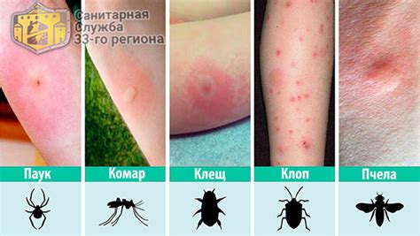Клопы: симптомы и проблемы