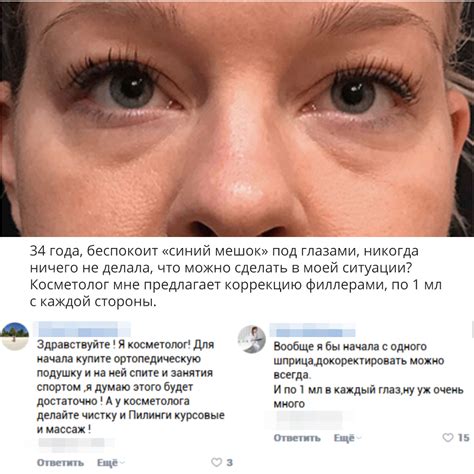 Когда видны первые результаты от использования сферогеля под глаза