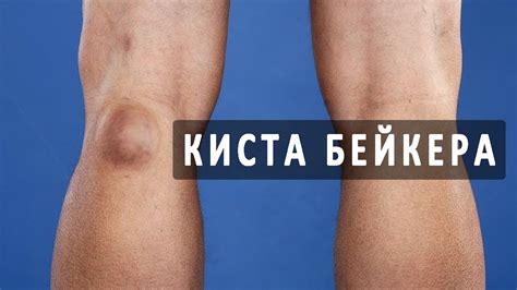 Когда появляется навык вставания на колени