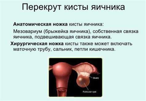 Круглые кисты: способы лечения без операции