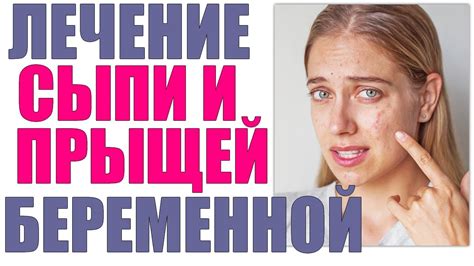 Лечение зуда на лице во время беременности