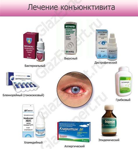 Лечение конъюнктивита