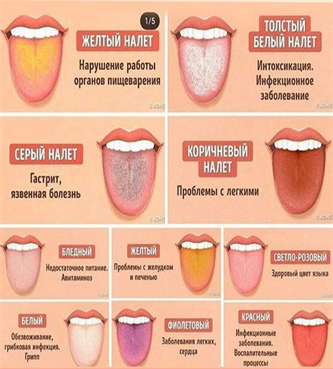 Лечение кровотечения из языка