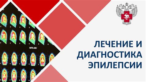 Лечение эпилепсии у детей: основные методы