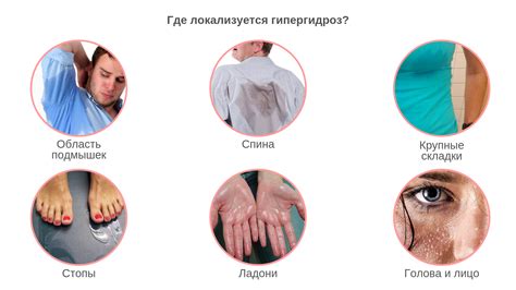 Медикаментозные методы лечения повышенного потоотделения рук и ног
