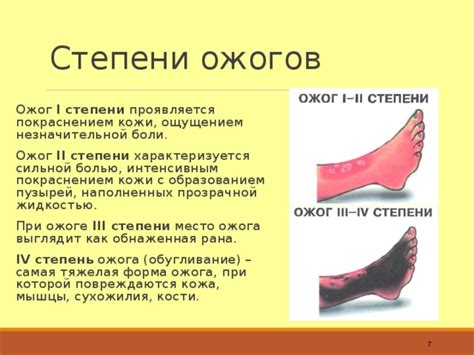 Меры предосторожности при загаре с покраснением кожи