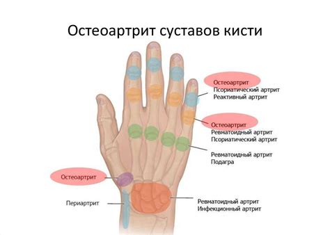 Метаемость и зуд в мизинце на левой руке