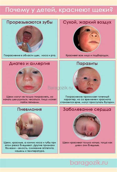 Методы лечения отёка щеки