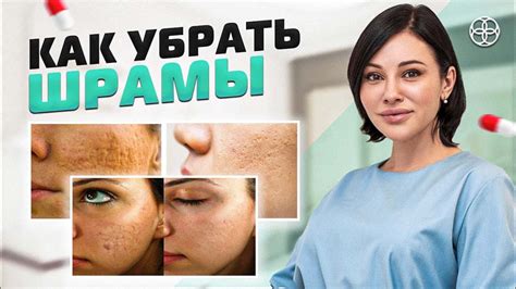 Методы лечения ран и шрамов