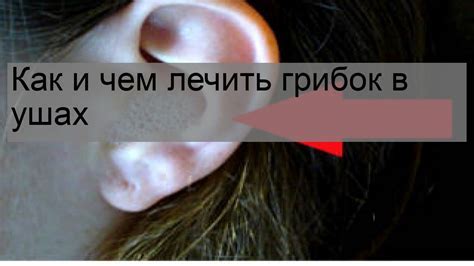 Методы лечения эха в ухе при разговоре