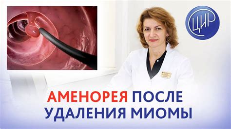 Методы удаления миомы после 40 лет: советы экспертов