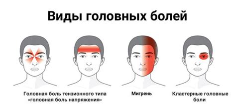 Мигрень и головные боли