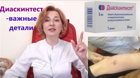 Мифы о диаскин тесте и повышении температуры