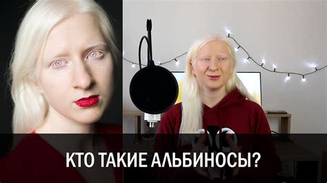 Мифы о карих глазах у альбиносов