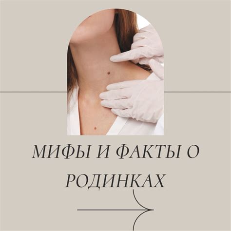 Мифы о росте родинок