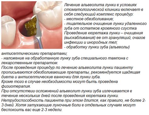 Миф №1: Отвергаемость флюса на десне