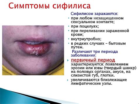 Миф 2: Сифилис передается только половым путем