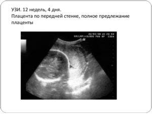 Моменты, когда ребенок начинает двигаться по передней стенке матки