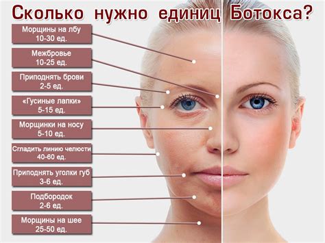 Морщины: редкий сигнал времени