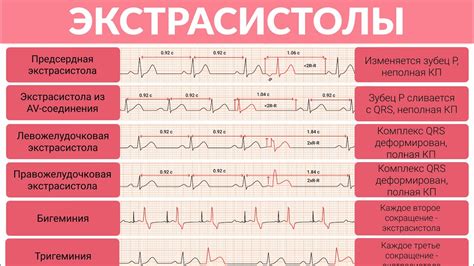 Наджелудочковая экстрасистолия