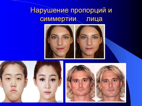 Нарушение естественных пропорций лица
