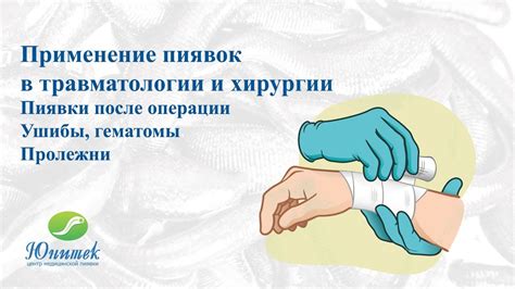 Научное обоснование эффективности использования пиявок при простуде
