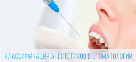 Начало систематического применения анестезии в стоматологии