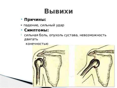 Невозможность двигать конечностями: причины и лечение