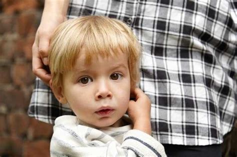 Недостатки открытия головки у новорожденных