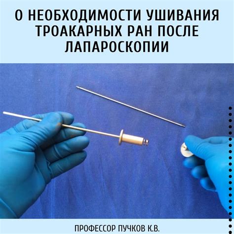 Необходимость закрытия поддувала