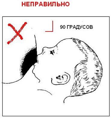 Неправильное прикрепление ребенка к груди