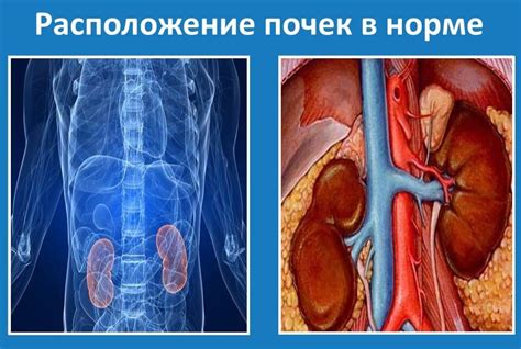 Непредвиденные последствия удаления почки и их возможные причины
