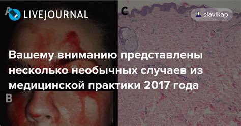 Несколько необычных случаев опьянения