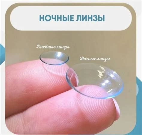 Ночные линзы: решение для идеального зрения