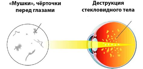 Ограничения при красивых глазах