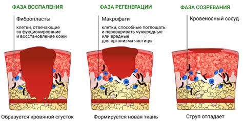 Ожоги пузырь: помощь и вскрытие