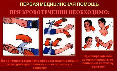 Оказание первой помощи при кровотечении
