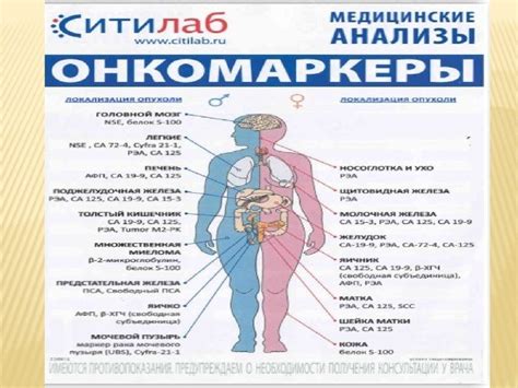 Описание недуга