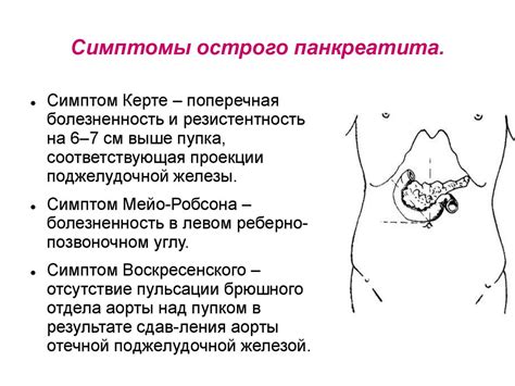 Опознать присутствие расширенного живота